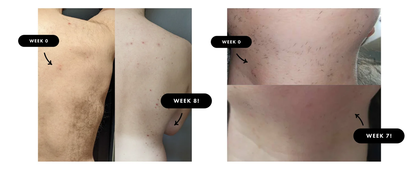 SmoothSkin Pro 9
