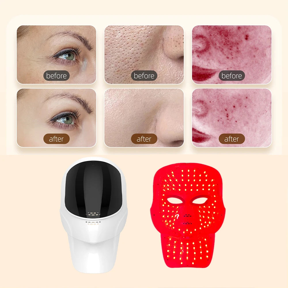 7-Color LED Face & Neck Mask